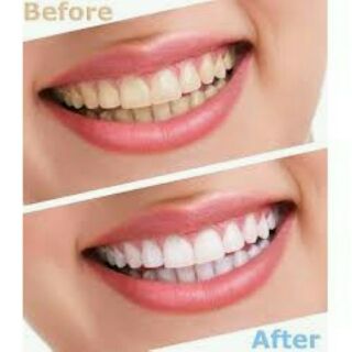 Kem đánh răng Colgate Optic White 141gr