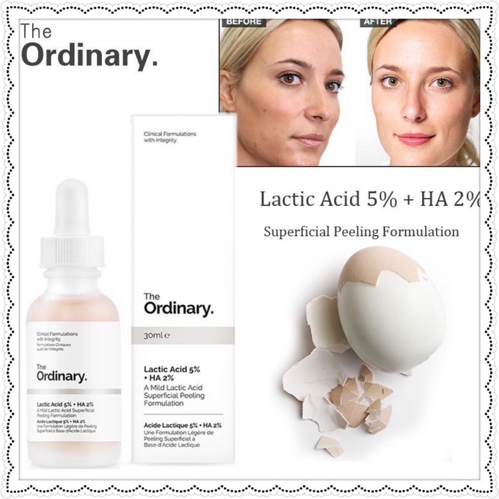 Serum The Odinary lactic acid 10% làm sáng da giảm thâm