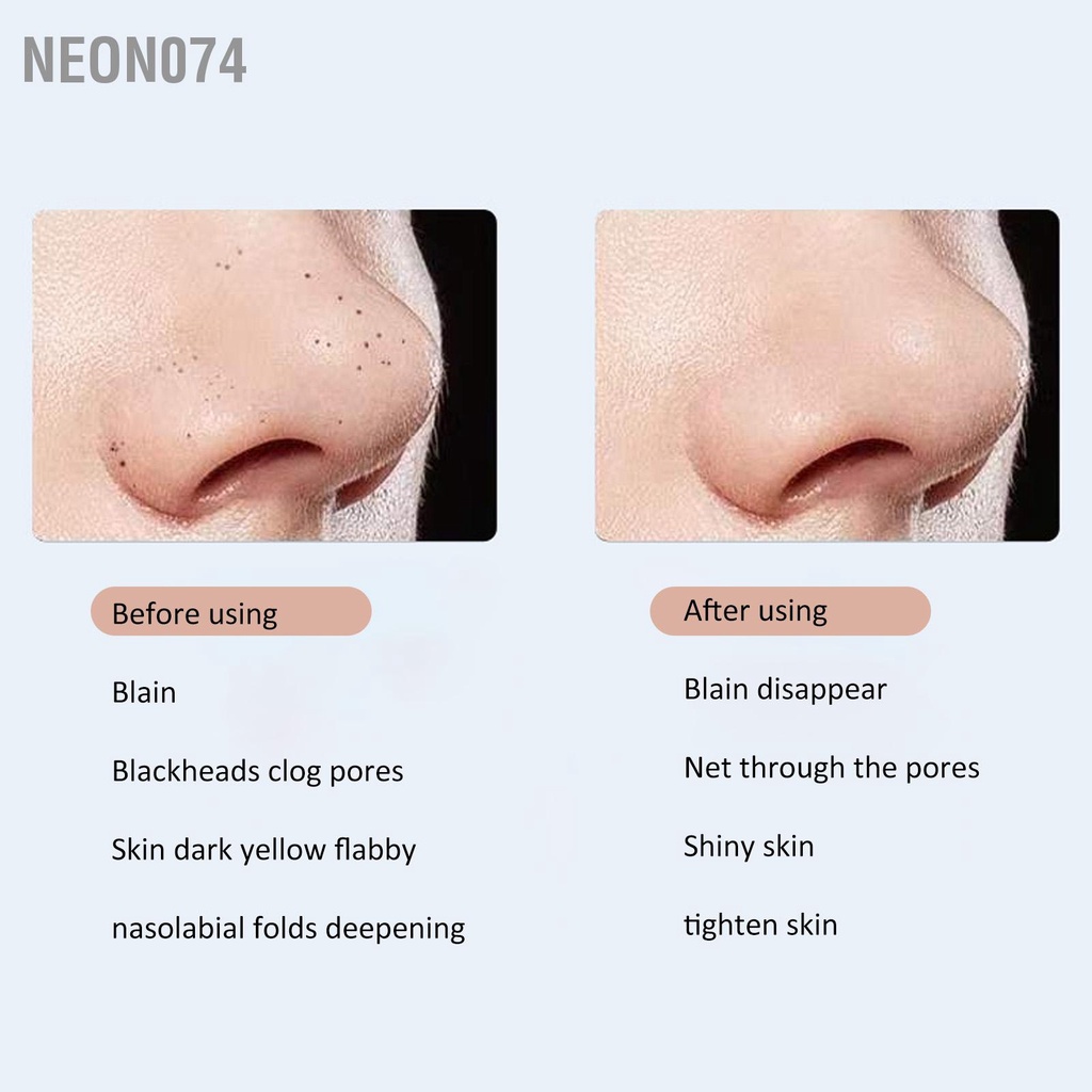 Neon074 Máy cà da sủi da mặt ion tẩy tế bào chết EMS làm sạch bã nhờn lỗ chân lông - máy đẩy mụn đầu đen Siêu Âm Loại Bỏ Mụn Đầu Đen