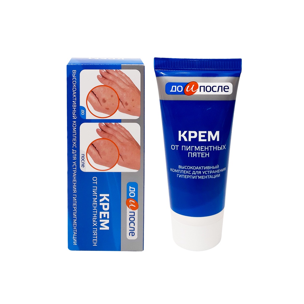 Kem Nám Tay Kpem Nga 45ml Kem Giảm Đốm Nâu Tay Đồi Mồi