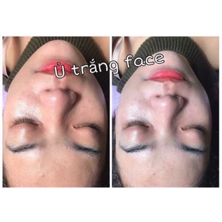 Ủ Trắng Face Dịch Yến