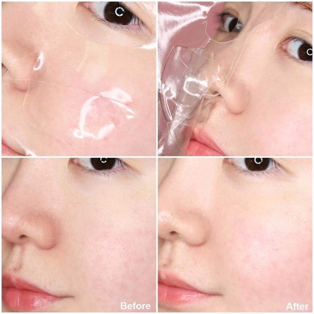Mặt nạ thạch CELDERMA Hydrogel Mask