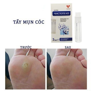 Bộ Đôi Thần Thánh Gel Tẩy Nốt Ruồi, Mụn Cơm... Kết Hợp Kem Mờ Sẹo - Hàng Nga Siêu Hot - Y336