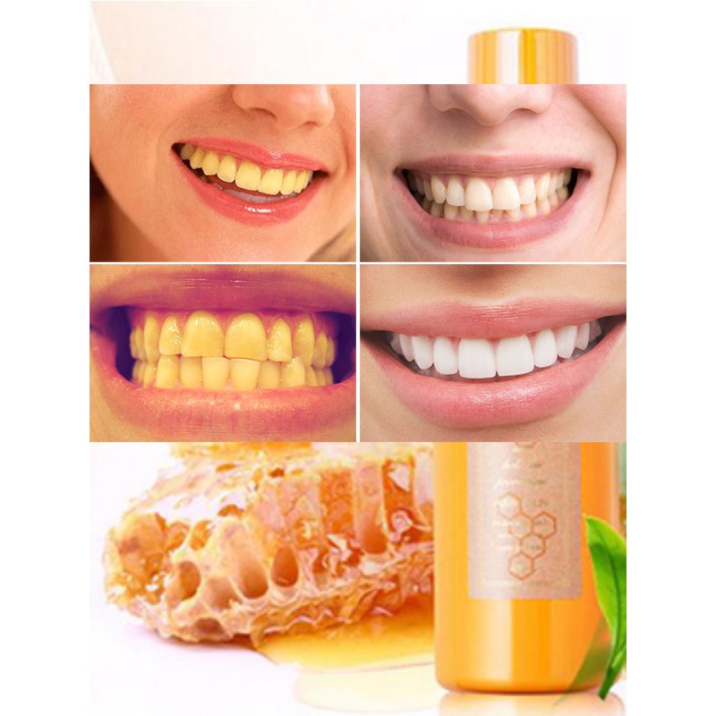 NƯỚC SÚC MIỆNG PROPOLINSE NHẬT BẢN 600ML CHAI VÀNG CHÍNH HÃNG