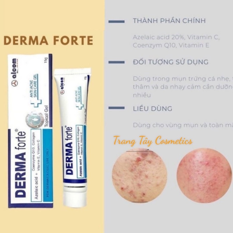 Kem Giảm Mụn Ngừa Thâm Trứng Cá, Mụn Ẩn, Mụn Đầu Đen Derma Forte