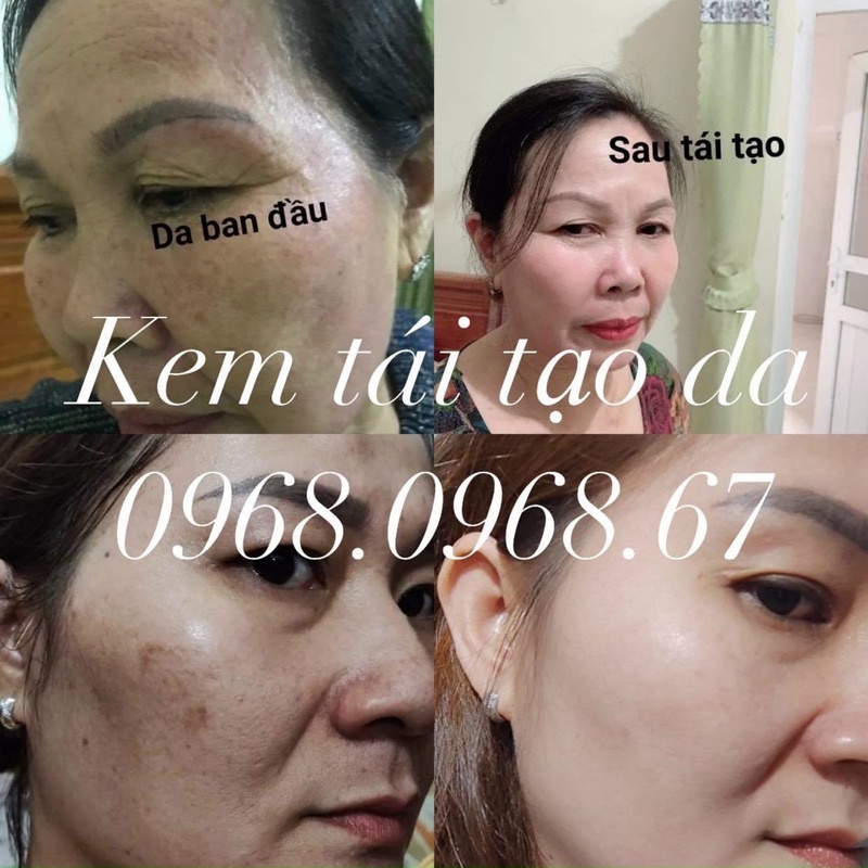 Kem tái tạo chamomileskill