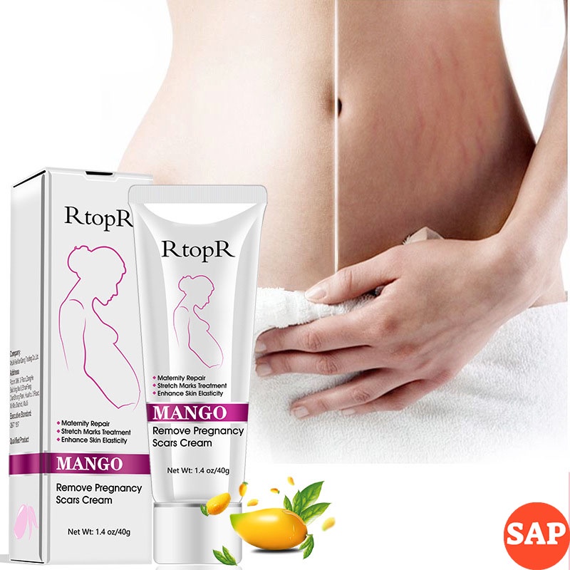 Kem Làm Mờ Rạn Da, Xóa Sẹo Sau Sinh/Rạn Do Tăng Cân Cấp Ẩm Phục Hồi Tái Tạo Da RtopR Mango Remove Pregnancy Scars Cream