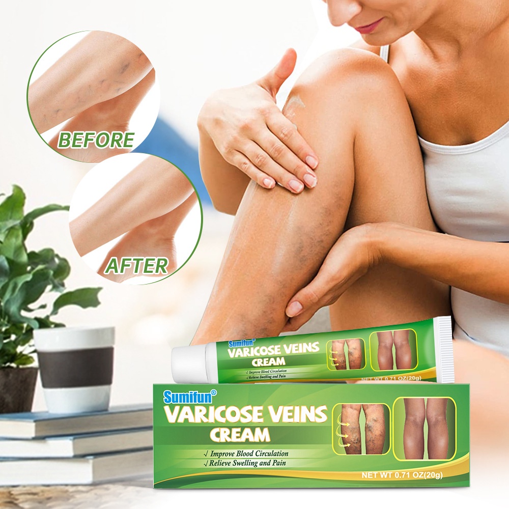 Kem chống giãn tĩnh mạch, tinh chất thảo dược thiên nhiên 100%, chống suy giãn, giảm đau, ngứa