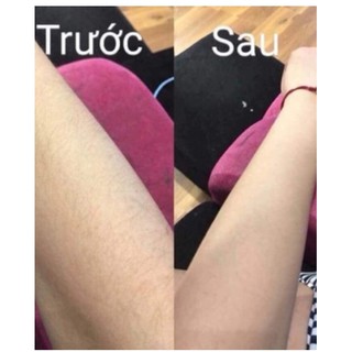 Máy Wax Lông Tẩy Lông Kemei