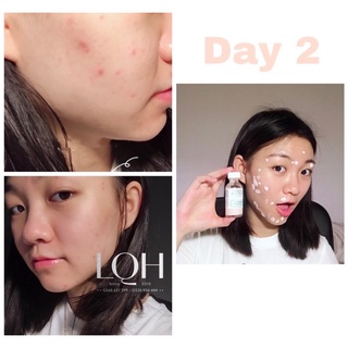 Chấm mụn thần thánh Mario Badescu Drying Lotion