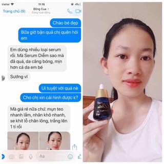 Serum đông Y DIỄM
