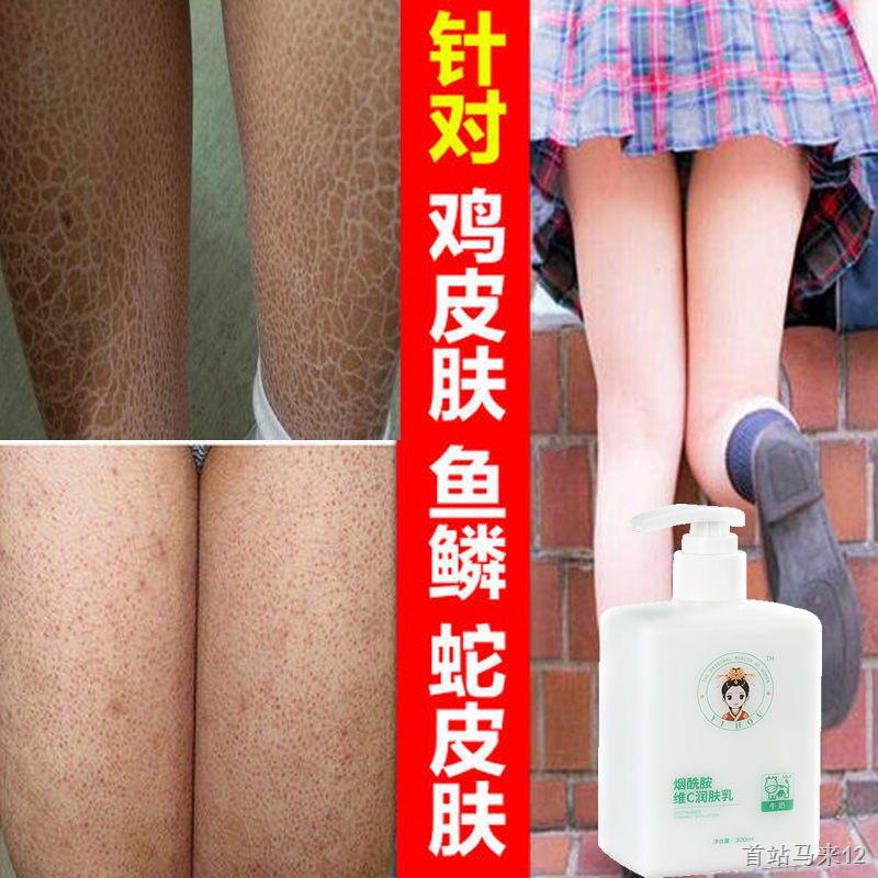 Kem Dưỡng Thể Làm Trắng Da Mùa Đông Dạng Ống Hút Dưỡng Ẩm Loại Bỏ Da Gà Lâu Trôi Có Hương Thơm hl21.10.8 szmalai12.my