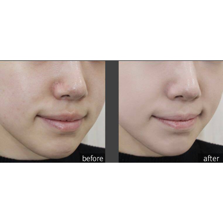 Phấn Nước Che Phủ Hoàn Hảo Aprilskin Black Magic Snow Cushion Mẫu Mới | BigBuy360 - bigbuy360.vn