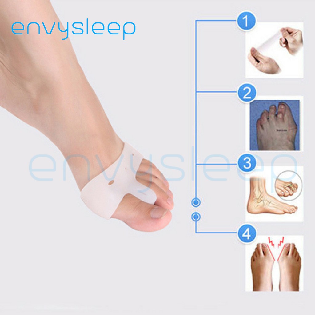 [Follow_ sale] Đệm silicon CHÍNH HÃNG ENVYSLEEP chống chai và cong vẹo/biến dạng ngón chân