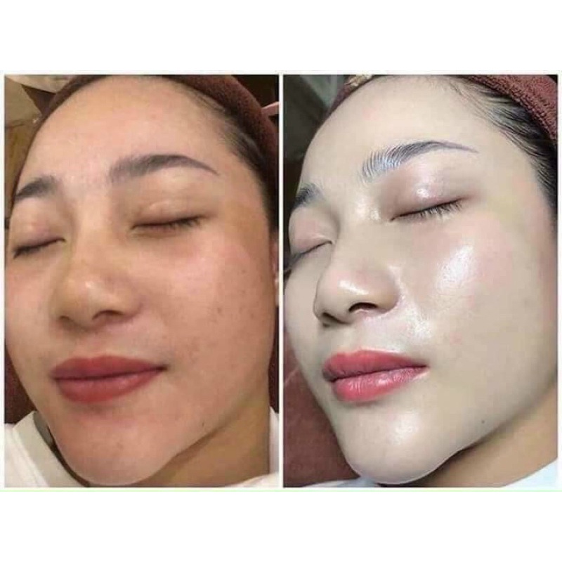 Peel Căng Bóng Collagen Morebella