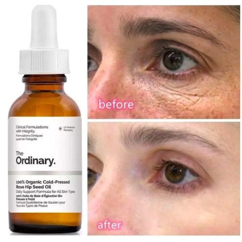 Serum chống lão hoá mắt The Ordinary Caffeine Solution 5% + EGCG 30ml giảm quầng thâm, nếp nhăn và bọng mắt