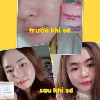 (Chính hãng) kem collagen plus vit e
