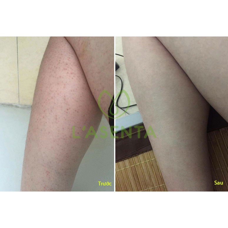 Muối tắm,Muối tắm loại bỏ mụn lưng viêm nang lông massage dưỡng nhan Doctor Beauty