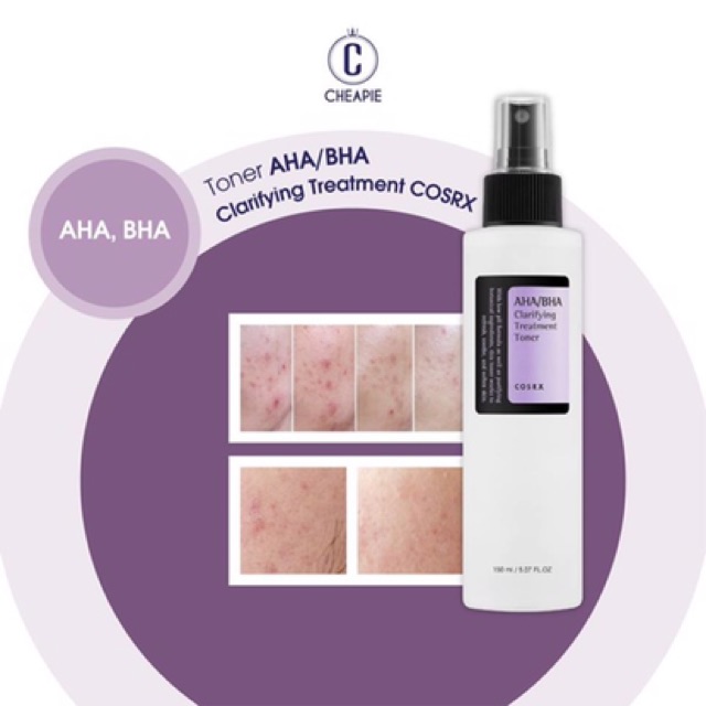 Nước Hoa Hồng cho da Mụn TONER COSRX AHA/BHA Clarifying Treatment Toner 150ml