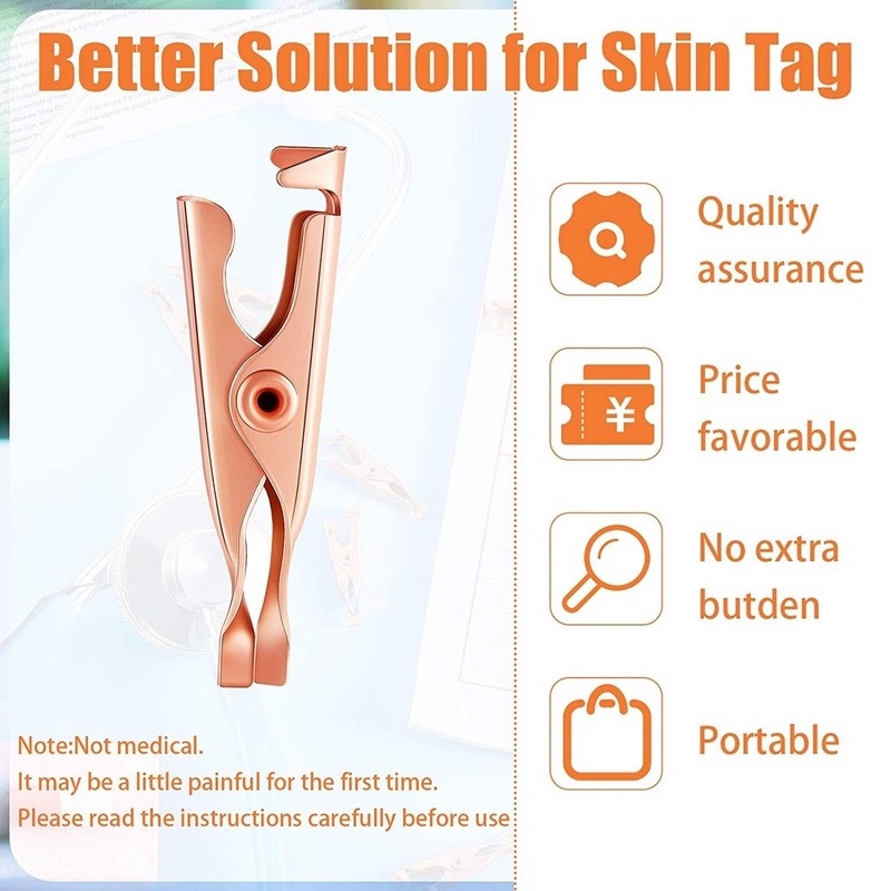 Bộ 2 Kẹp Loại Bỏ Mụn Trứng Cá / Vết Thâm Tức Thì Tiện Dụng Cho Mọi Lứa Tuổi