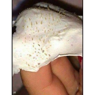 Mặt lạ lột mụn đầu đen nha đam