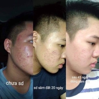 Tinh Chất Sâm Đất DR CELL 50ml