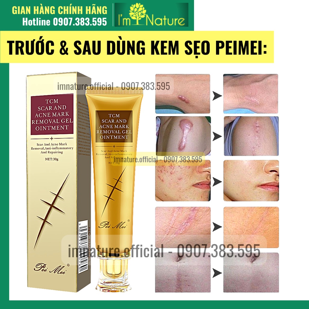 Kem Sẹo Peimei - Giảm Sẹo Và Rạn Da Hiệu Quả Sau 1 Tuần 30gr