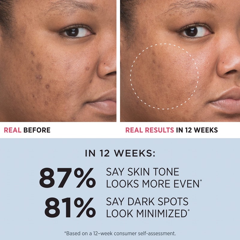 20% Niacinamide 4% Vitamin C trắng da mờ thâm dupe Paula’s Choice