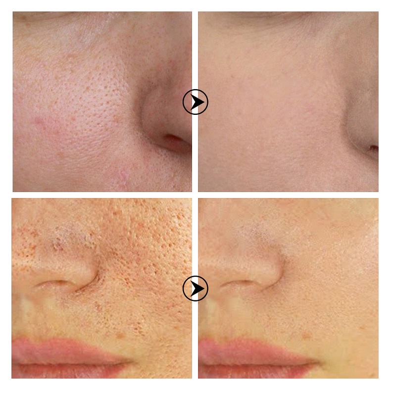 Serum Hyaluronic Acid Dưỡng Ẩm Se Khít Lỗ Chân Lông Và Phục Hồi Da Khô