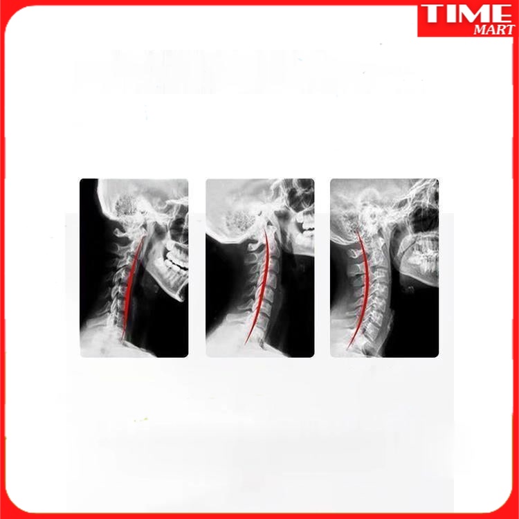 Gối Kê Cổ Sửa Thẳng Và Chống Cung Chuyên Dụng Hỗ Trợ Ngủ Massage Kéo Phong Phú Gói Sưởi Ấm Chỉnh Sửa Gối Bảo Vệ Cổ [TIME