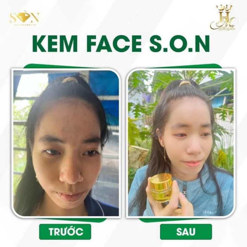 KEM FACE NÁM SON