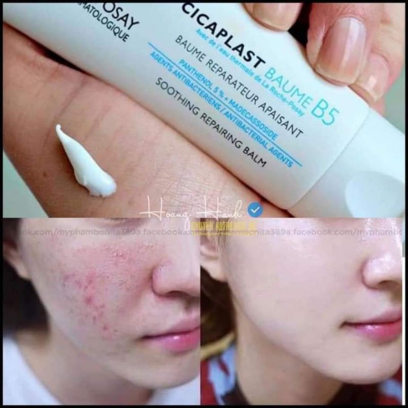 Kem Dưỡng La Roche Posay Cicaplast Baume B5 40ml - Kem Dưỡng Làm Dịu Kích Ứng Và Phục Hồi Da