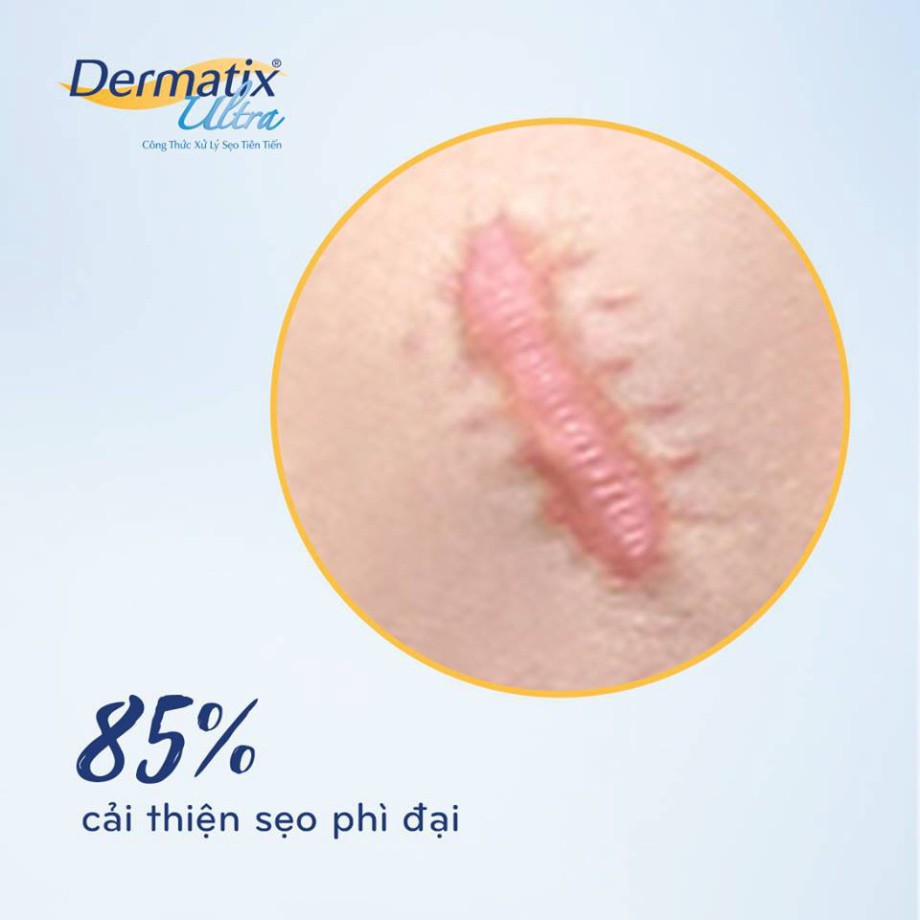 [CHÍNH HÃNG] Dermatix® Ultra – GEL LÀM MỜ SẸO – 15g