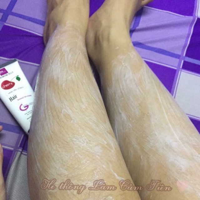 Triệt lông _ Mwhite