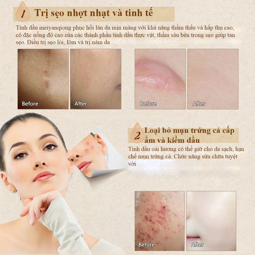 MeiYanQiong TINH CHẤT LAVENDER TÁI TẠO VÀ PHỤC HỒI DA LÀM TRẮNG DA LÀM MỜ SẸO MỤN TRỨNG CÁ | BigBuy360 - bigbuy360.vn