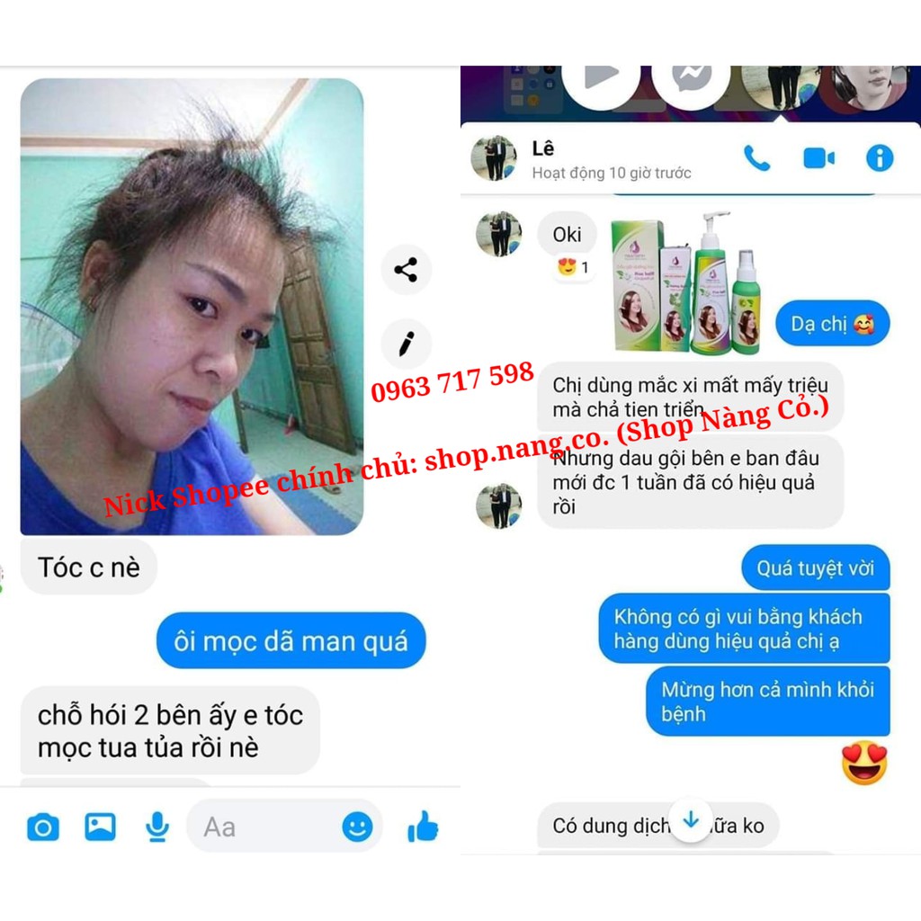 (CAO CẤP) Tinh Dầu Bưởi NGÂN BÌNH Kích MỌC TÓC dày dài, Ngăn RỤNG TÓC hói đầu, Hair Lotion Dạng Xịt Dưỡng mềm mượt