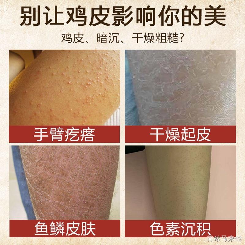 Kem Dưỡng Thể Làm Trắng Da Mùa Đông Dạng Ống Hút Dưỡng Ẩm Loại Bỏ Da Gà Lâu Trôi Có Hương Thơm hl21.10.8 szmalai12.my