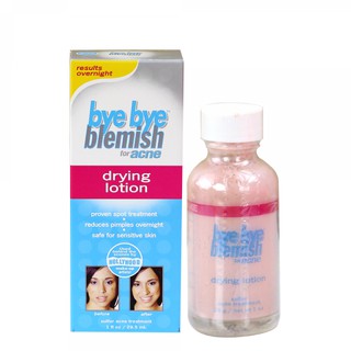 Lotion mụn bye bye blemish for acne drying