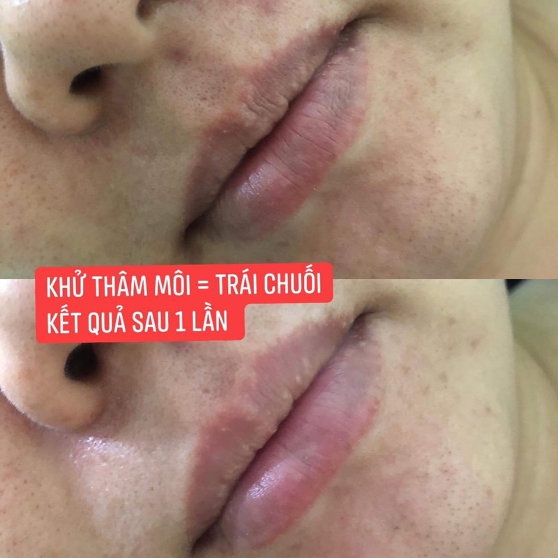 CHÍNH HÃNG Chuối Cấy Trắng Thải Chì Zenpali X3 Phiên Bản Plus