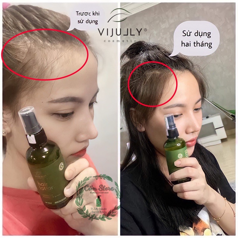 [COMBO 3 CHAI] Tinh Dầu Bưởi Vi Jully 100% Thiên Nhiên KÍCH MỌC TÓC-GIẢM RỤNG TÓC | BigBuy360 - bigbuy360.vn