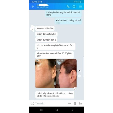 Bộ Sản Phẩm Kem Mờ Nám Da Pink Tulip, Cam Kết Sạch 80% Sau 2 Tháng