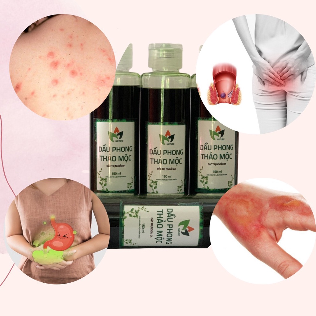Dầu Phong Thảo Mộc 100ml (Chính Hãng) nguyên liệu từ 12 vị thảo dược
