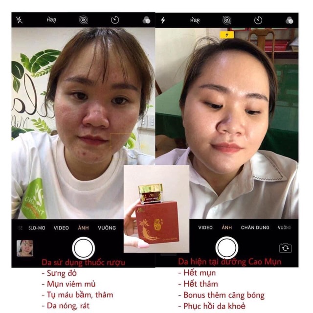 36 VỊ - CAO MỤN SÂM ĐỎ 5GR | BigBuy360 - bigbuy360.vn
