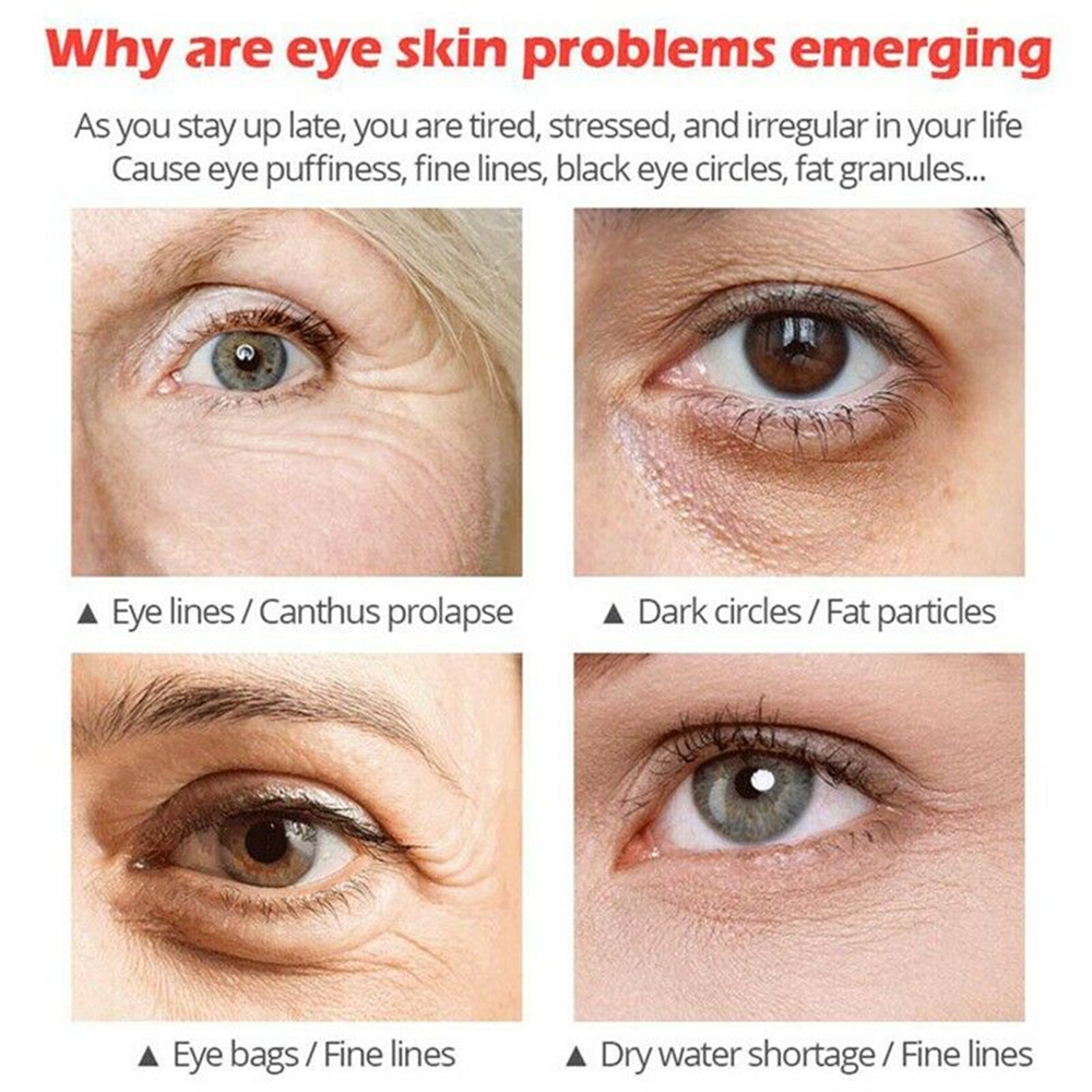 [Hàng mới về] Kem chống lão hóa mắt loại bỏ quầng thâm / nếp nhăn 20g