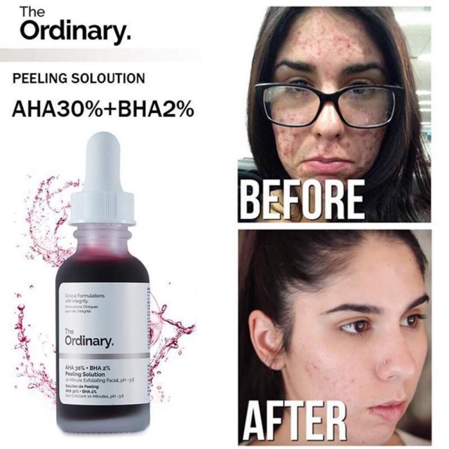 [Bill US] TINH CHẤT TẨY DA CHẾT HÓA HỌC THE ORDINARY AHA 30% + BHA 2% PEELING SOLUTION