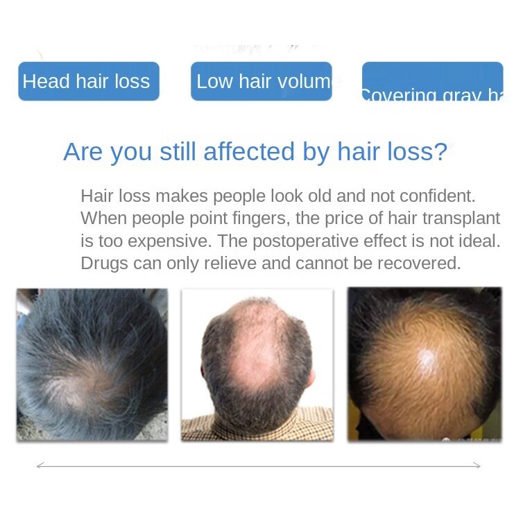 Tóc giả làm đẹp chuyên nghiệp cho nam