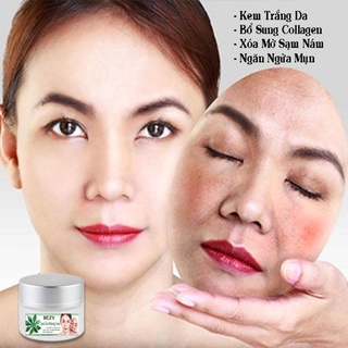 Kem trắng da xóa mờ thâm nám bezy