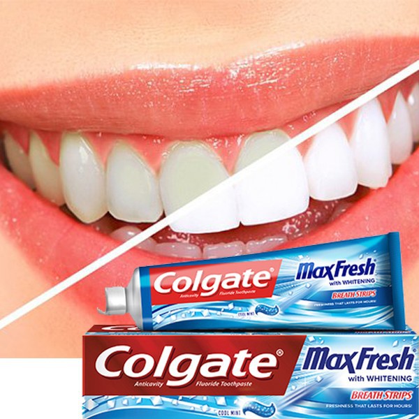 Kem Đánh Răng Colgate Maxfresh - Mỹ - 215g