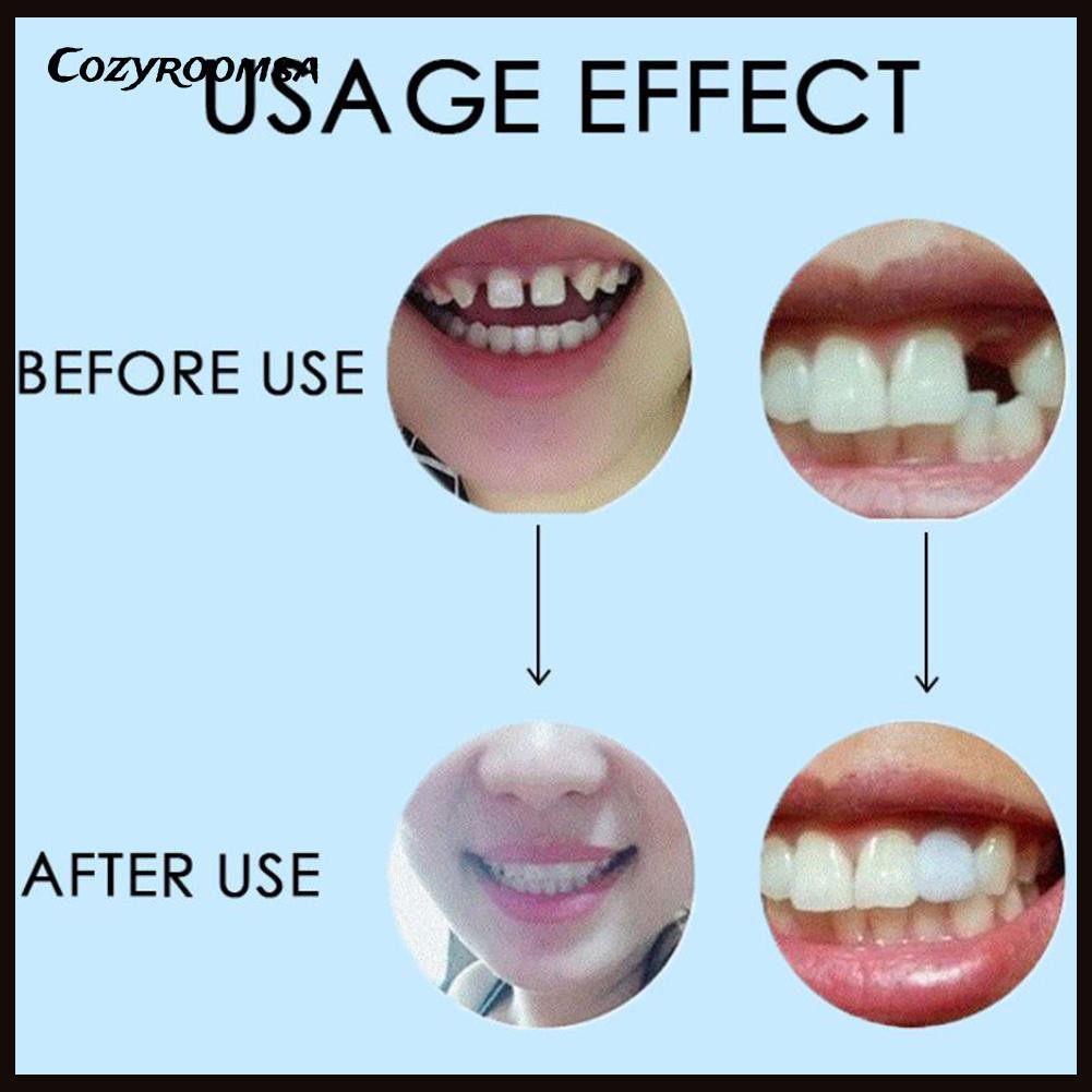 [Hàng mới về] Keo rắn dán răng giả 10g / 100g dùng để sửa chữa răng giả tiện dụng