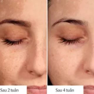 (Bill Đức) Tinh chất nám Eucerin Đức